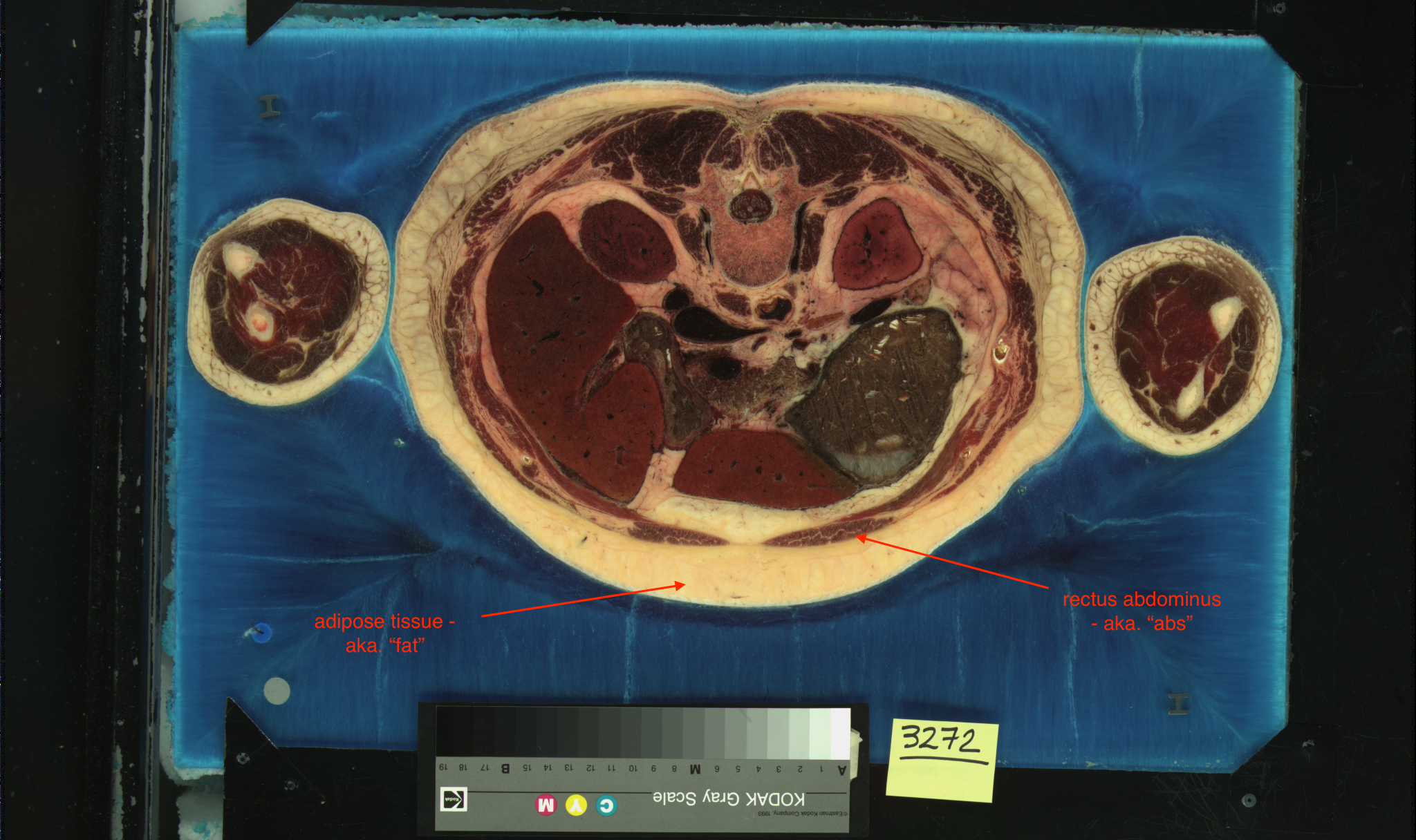 abs cross-section_female